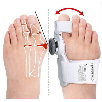 Was tun gegen Hallux Valgus?