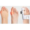 Hallux Valgus Korrektur Schiene Verstellbare Valgus Schiene  Bandage für Hallux Valgus