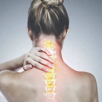 Zervikale Spondylose: Ursachen, Symptome und Behandlung