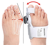 Hallux Valgus Schienen